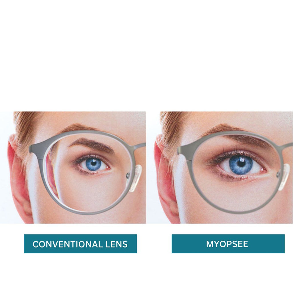 Nikon Myopsee DAS Single Vision Lens